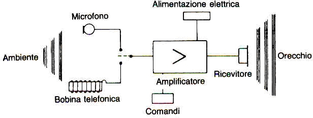 Schema a blocchi di una protesi acustica